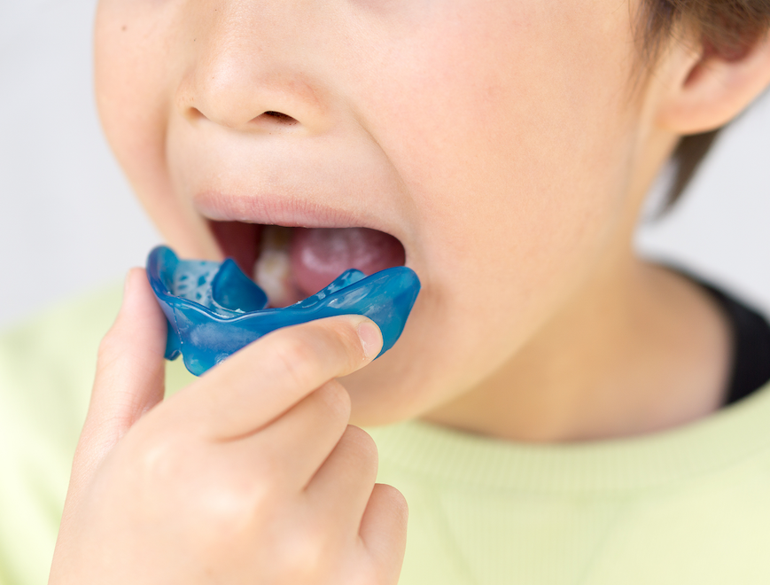 小児矯正のイメージ